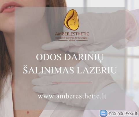 Apgamų, papilomų, seborėjinių keratozių, karpų šalinimas lazeriu