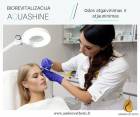 Biorevitalizacija su preparatu ,,Aquashine“