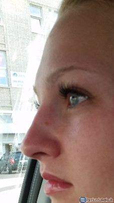 Blakstienu priauginimas Vilniuje