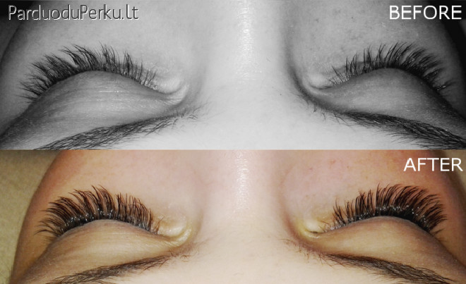 Blakstienu priauginimas