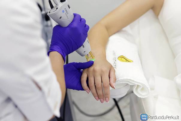 Lazerinė depiliacija Kaune