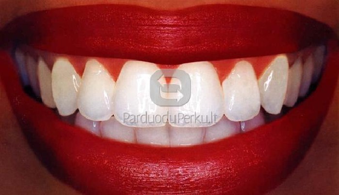 Nemokamas dantų gydymas