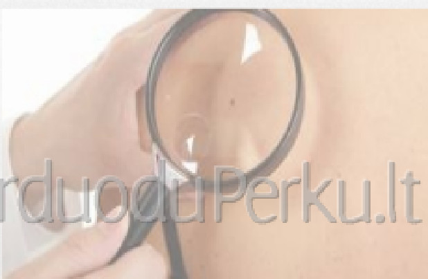 Odos ligų gydymo patarimai