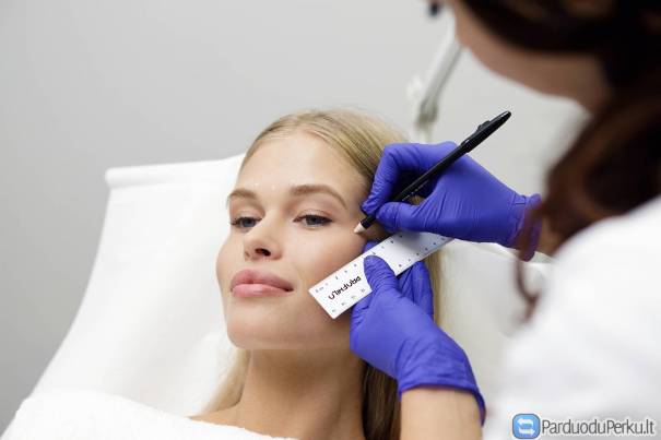 Profhilo injekcijos Kaune