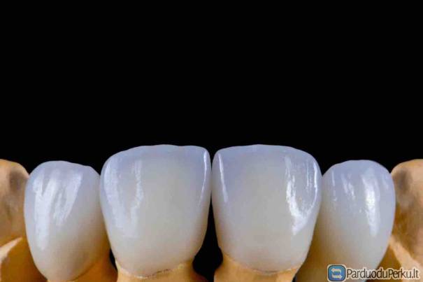 Visos cirkonio dantų gamybos paslaugos vienoje vietoje!